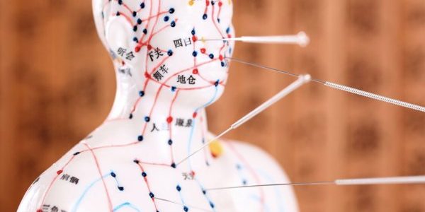 Chinese Medicine to be included under the HPCA Act(2003) Chinese Medicine to be included under the HPCA Act (2003)